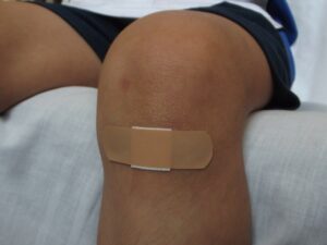 Child with bandage on knee in Oshawa, Ontario, Canada
